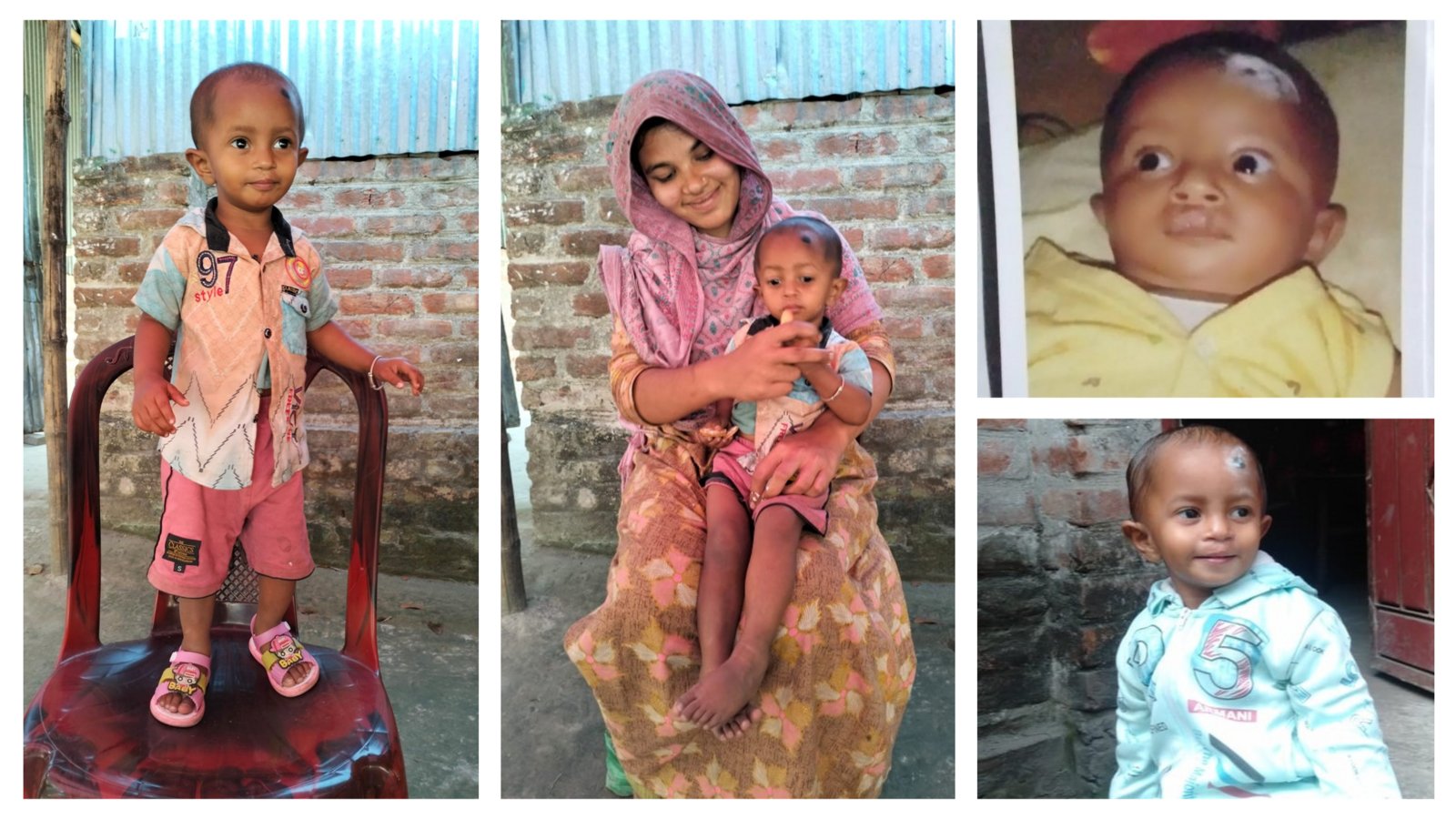 Rajin Babu before and after treatment — recovery through the Healthy Village Urban programme